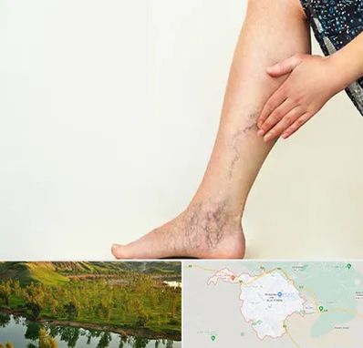 دکتر واریس در بهبهان