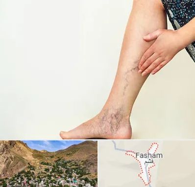 دکتر واریس در فشم