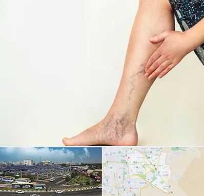 دکتر واریس در منطقه 15 تهران 