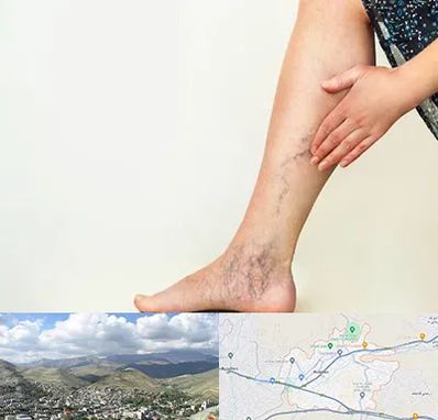 دکتر واریس در رودهن