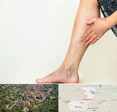 دکتر واریس در دماوند