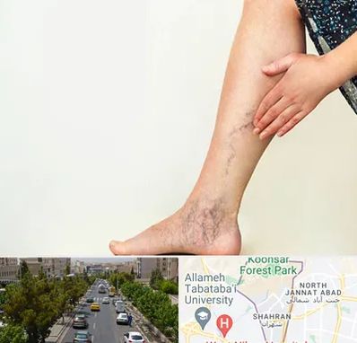 دکتر واریس در شهران 