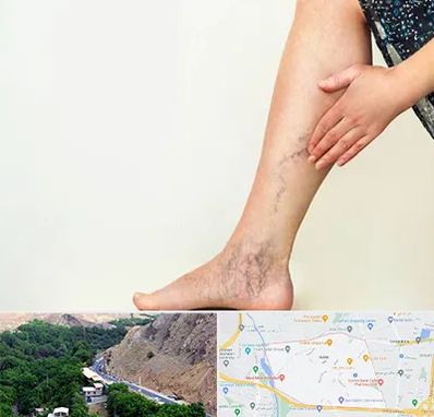 دکتر واریس در کن 