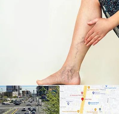 دکتر واریس در ستاری 