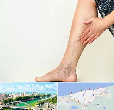 دکتر واریس در بابلسر