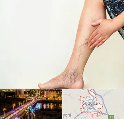 دکتر واریس در سقز