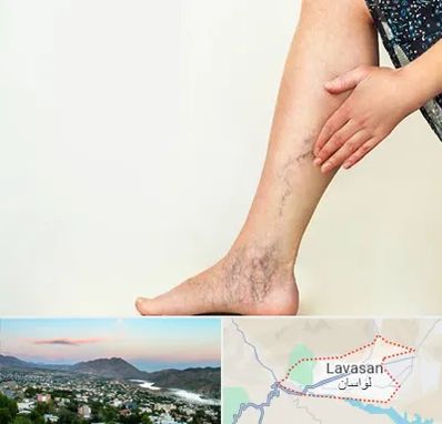 دکتر واریس در لواسان