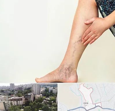 دکتر واریس در اوین