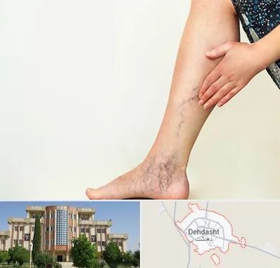 دکتر واریس در دهدشت