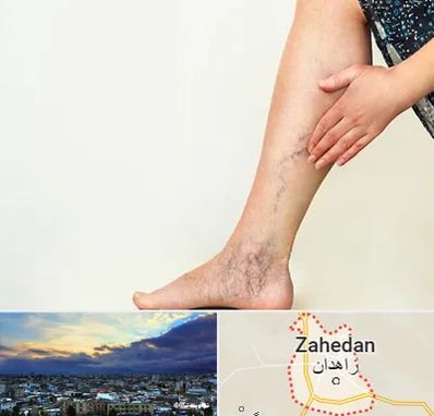 دکتر واریس در زاهدان