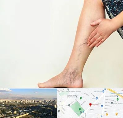 دکتر واریس در هنگام 