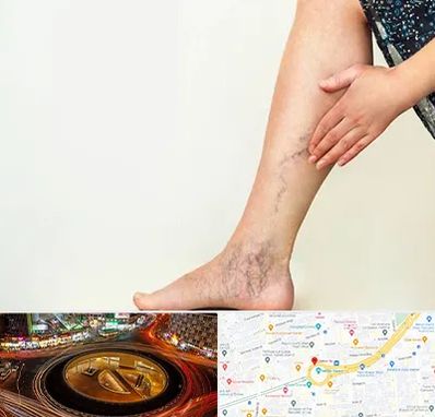 دکتر واریس در میدان ولیعصر 