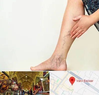 دکتر واریس در بازار وکیل شیراز