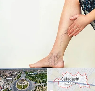 دکتر واریس در صفادشت