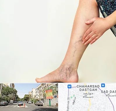 دکتر واریس در چهارصد دستگاه 