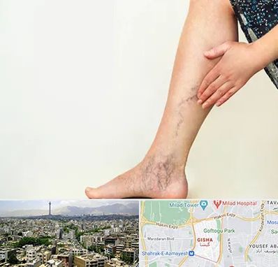 دکتر واریس در گیشا 