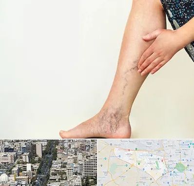 دکتر واریس در منطقه 18 تهران 