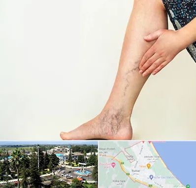 دکتر واریس در رودسر