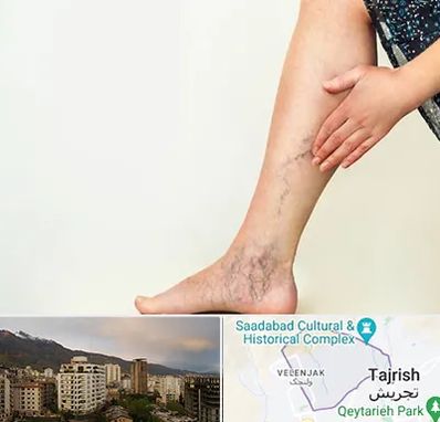 دکتر واریس در زعفرانیه 