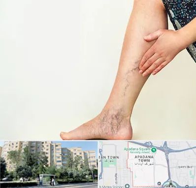 دکتر واریس در آپادانا