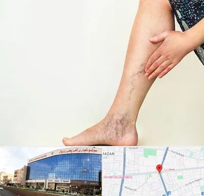 دکتر واریس در نصف راه تبریز