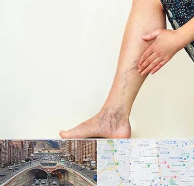 دکتر واریس در منطقه 10 تهران 