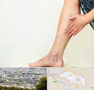 دکتر واریس در یاسوج