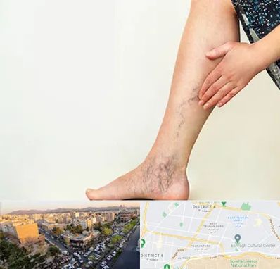 دکتر واریس در تهرانپارس 