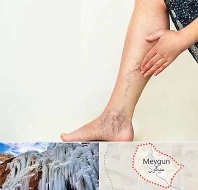 دکتر واریس در میگون