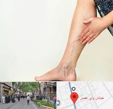 دکتر واریس در ولیعصر شهریار