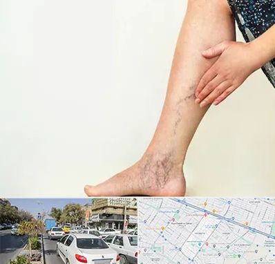 دکتر واریس در مفتح مشهد 