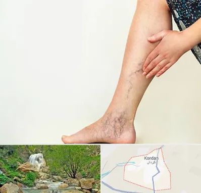 دکتر واریس در کردان