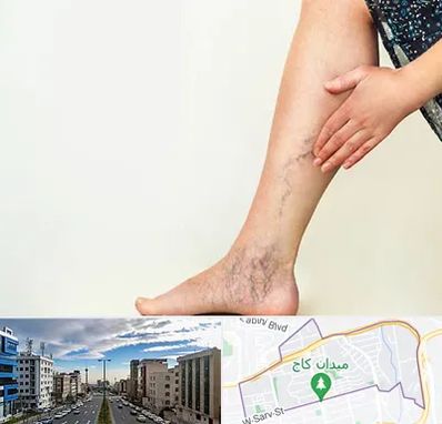 دکتر واریس در سعادت آباد 