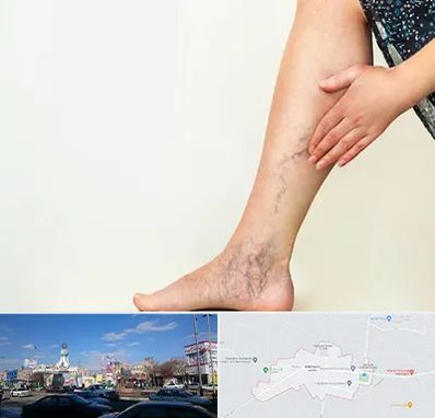 دکتر واریس در ماهدشت کرج 