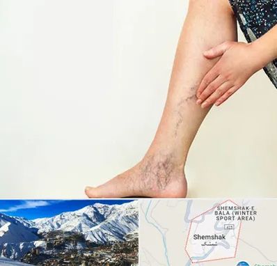 دکتر واریس در شمشک