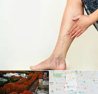 دکتر واریس در منطقه 6 تهران 