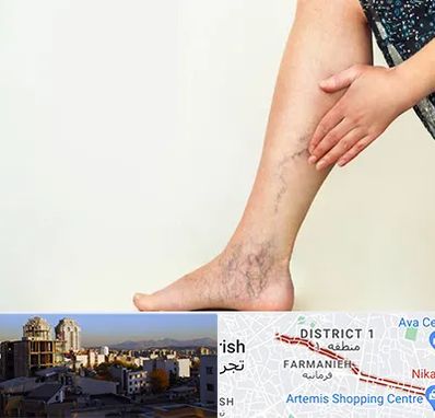 دکتر واریس در فرمانیه 