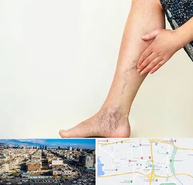 دکتر واریس در شهرک راه آهن 