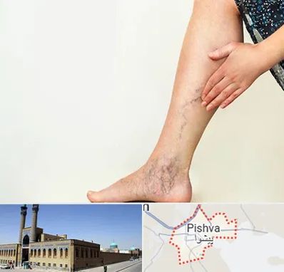 دکتر واریس در پیشوا