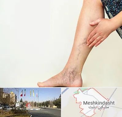 دکتر واریس در مشکین دشت