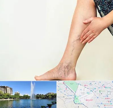 دکتر واریس در کوهسنگی مشهد 