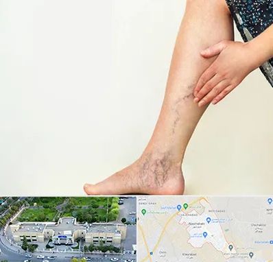 دکتر واریس در نسیم شهر