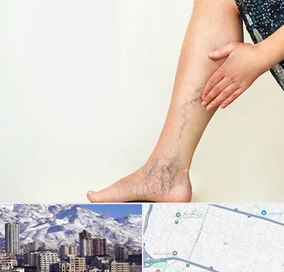 دکتر واریس در ازگل