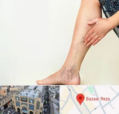 دکتر واریس در بازار رضا مشهد