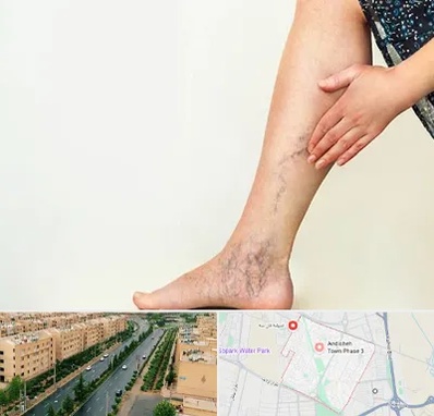 دکتر واریس در فاز سه اندیشه