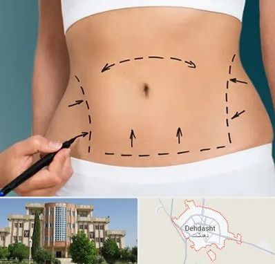 عمل ابدومینوپلاستی در دهدشت