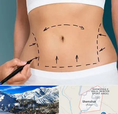 عمل ابدومینوپلاستی در شمشک