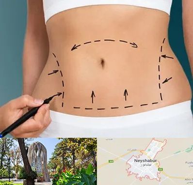 عمل ابدومینوپلاستی در نیشابور