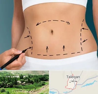 عمل ابدومینوپلاستی در طالقان