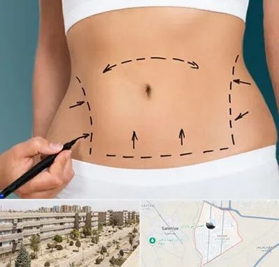 عمل ابدومینوپلاستی در واوان اسلامشهر